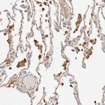 LCHN Antibody in Immunohistochemistry (Paraffin) (IHC (P))