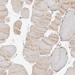 LCHN Antibody in Immunohistochemistry (Paraffin) (IHC (P))