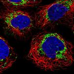 MACC1 Polyclonal Antibody