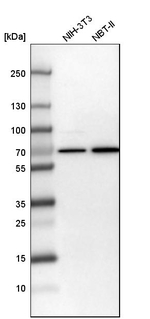 Transketolase Antibody in Western Blot (WB)