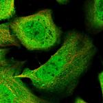 KLHL7 Polyclonal Antibody