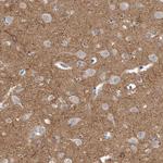 KLHL7 Antibody in Immunohistochemistry (Paraffin) (IHC (P))