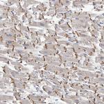 KLHL7 Antibody in Immunohistochemistry (Paraffin) (IHC (P))