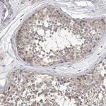 KLHL7 Antibody in Immunohistochemistry (Paraffin) (IHC (P))