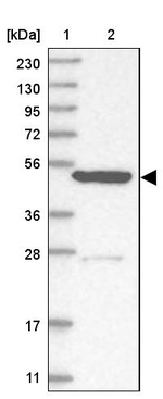 KLHL7 Antibody in Western Blot (WB)
