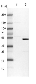KLHL7 Antibody in Western Blot (WB)
