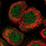 KLHL7 Polyclonal Antibody