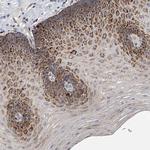 KLHL7 Antibody in Immunohistochemistry (Paraffin) (IHC (P))