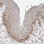 RFC2 Antibody in Immunohistochemistry (Paraffin) (IHC (P))