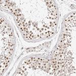RFC2 Antibody in Immunohistochemistry (Paraffin) (IHC (P))