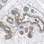 Calpain 13 Polyclonal Antibody