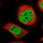 ZNF789 Polyclonal Antibody