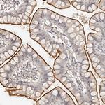 ZNF789 Antibody in Immunohistochemistry (Paraffin) (IHC (P))