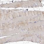 BAIAP2L1 Antibody in Immunohistochemistry (IHC)