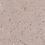 MTURN Antibody in Immunohistochemistry (Paraffin) (IHC (P))
