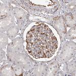 MTURN Antibody in Immunohistochemistry (Paraffin) (IHC (P))