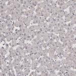 MTURN Antibody in Immunohistochemistry (Paraffin) (IHC (P))