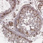 MTURN Antibody in Immunohistochemistry (Paraffin) (IHC (P))