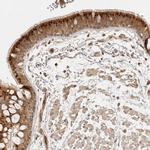 ANKRD61 Polyclonal Antibody