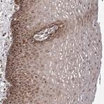 ZCCHC7 Antibody in Immunohistochemistry (Paraffin) (IHC (P))