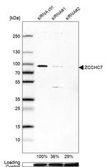 ZCCHC7 Antibody