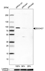 ZCCHC7 Antibody in Western Blot (WB)