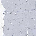 Septin-7 Antibody in Immunohistochemistry (IHC)