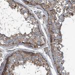 Septin-7 Antibody in Immunohistochemistry (IHC)