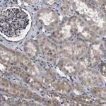 NRBP Polyclonal Antibody