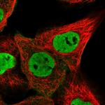 ZNF655 Polyclonal Antibody