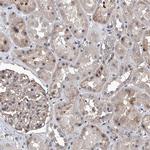 ZNF655 Antibody in Immunohistochemistry (Paraffin) (IHC (P))