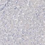 ZNF655 Antibody in Immunohistochemistry (Paraffin) (IHC (P))