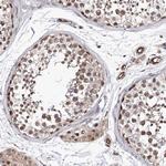 ZNF655 Antibody in Immunohistochemistry (Paraffin) (IHC (P))
