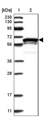 ZNF655 Antibody in Western Blot (WB)
