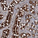 ZNF114 Polyclonal Antibody