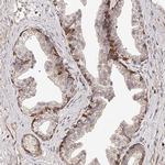 ZNF502 Polyclonal Antibody