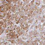 CYP2E1 Antibody in Immunohistochemistry (IHC)