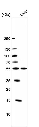 CYP2E1 Antibody in Western Blot (WB)