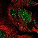 RANBP17 Polyclonal Antibody