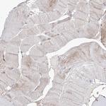 HGSNAT Antibody in Immunohistochemistry (Paraffin) (IHC (P))