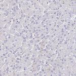 SLC11A1 Antibody in Immunohistochemistry (Paraffin) (IHC (P))