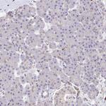 SLC11A1 Antibody in Immunohistochemistry (Paraffin) (IHC (P))