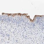 SBSPON Antibody in Immunohistochemistry (Paraffin) (IHC (P))