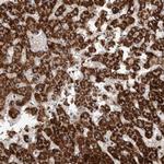 RNF217 Polyclonal Antibody