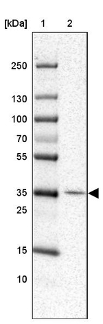 RNF217 Antibody in Western Blot (WB)