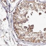 LAP3 Antibody in Immunohistochemistry (IHC)