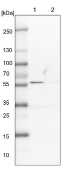 LAP3 Antibody in Western Blot (WB)