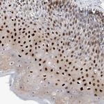 PHF20 Polyclonal Antibody