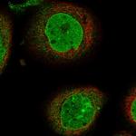 PHF20 Polyclonal Antibody