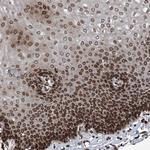 PHF20 Antibody in Immunohistochemistry (Paraffin) (IHC (P))
